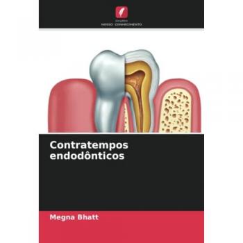 Contratempos endodônticos: DE