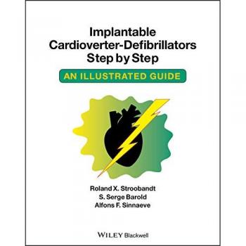 Implantable Cardioverter