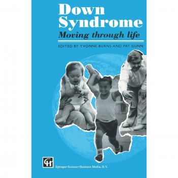 Down Syndrome : Moving through life