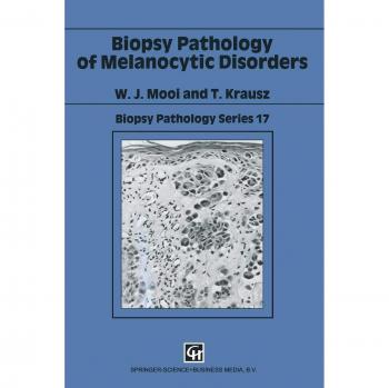 Biopsy Pathology of Melanocytic Disorders,  Biopsy Pathology Series