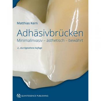 Adhäsivbrücken