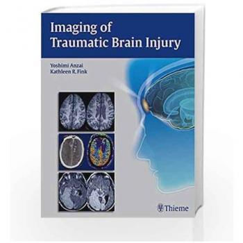 Imaging of Traumatic Brain Injury
