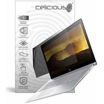 PrivacyLite Dual‑Mode Shield for HP Envy 17 AE102NA