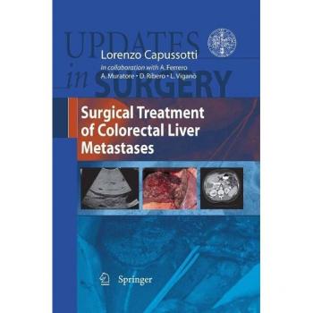 Vitalsource Technologies, Inc. Surgical Treatment Of Colorectal Liver Metastases