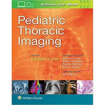 Pediatric Thoracic Imaging