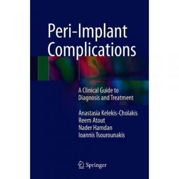 Peri-Implant Complications: A Clinical Guide to Diagnosis and Treatment