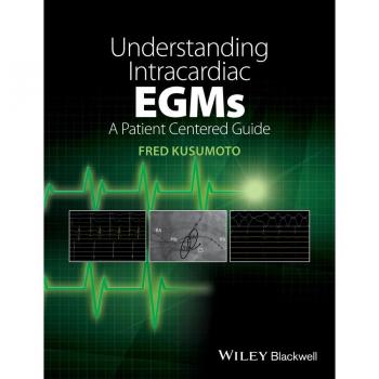 Vitalsource Technologies, Inc. Understanding Intracardiac Egms: A Patient Centered Guide