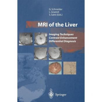 MRI of the Liver