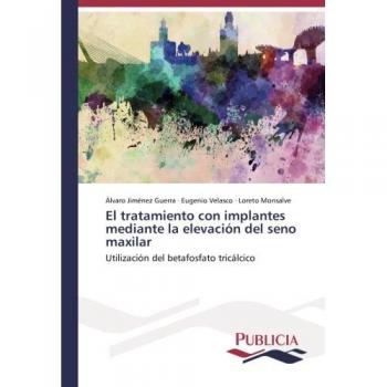 El tratamiento con implantes mediante la elevación del seno maxilar: Utilización del betafosfato tricálcico