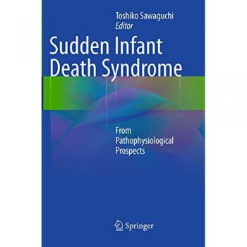 Sudden Infant Death Syndrome