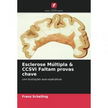 Schelling, Franz: Esclerose Múltipla & CCSVI Faltam provas chave