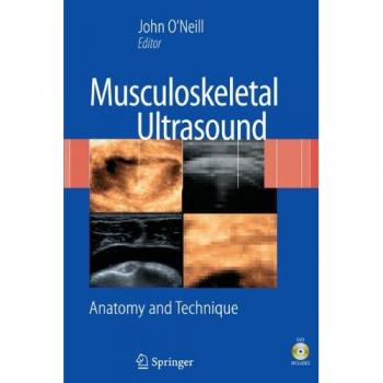 Musculoskeletal Ultrasound