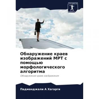Обнаружение краев изображений МРТ с помощью морфологического алгоритма: Обнаружение краев изображения: Obnaruzhenie kraew izobrazheniq