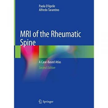 Tarantino, Alfredo: MRI of the Rheumatic Spine