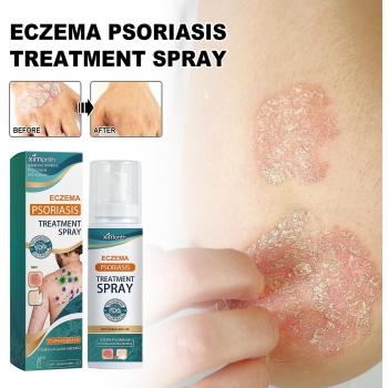 Spray apaisant pour le traitement du psoriasis 100ml