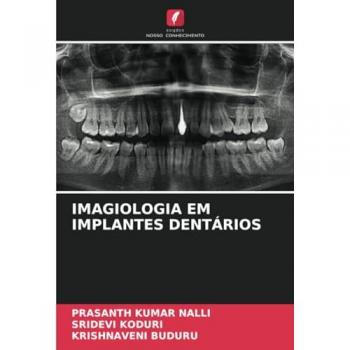 Nalli, Prasanth Kumar: IMAGIOLOGIA EM IMPLANTES DENTÁRIOS