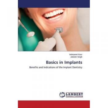 Basics in Implants: Benefits and Indications of the Implant Dentistry