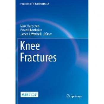 Knee Fractures (Strategies in Fracture Treatments)