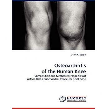 Osteoarthritis of the Human Knee: Composition and Mechanical Properties of osteoarthritic subchondral trabecular tibial bone