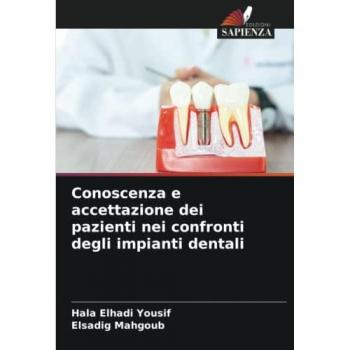 Conoscenza e accettazione dei pazienti nei confronti degli impianti dentali