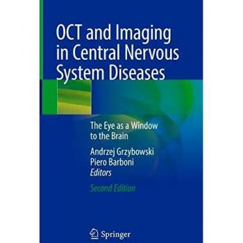OCT and Imaging in Central Nervous System Diseases