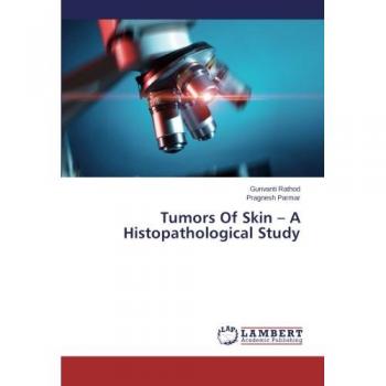 Tumors Of Skin