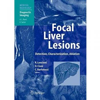 Focal Liver Lesions: Detection, Characterization, Ablation