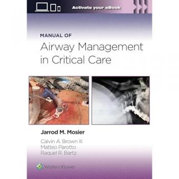 Manual of Airway Management in Critical Care: Print + eBook with Multimedia
