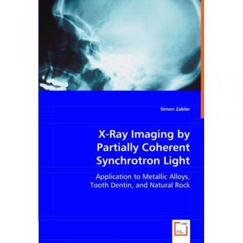 X-Ray Imaging by Partially Coherent Synchrotron Light