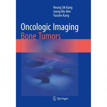 Oncologic Imaging: Bone Tumors