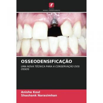 OSSEODENSIFICAÇÃO: UMA NOVA TÉCNICA PARA A CONSERVAÇÃO DOS OSSOS
