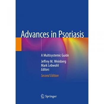 Advances in Psoriasis