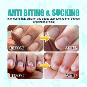 3pcs Stop Ongles