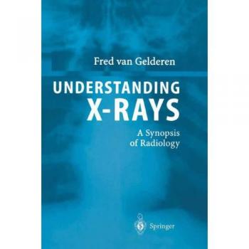 Gelderen, Fred van: Understanding X-Rays