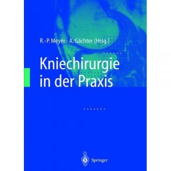 Kniechirurgie in der Praxis