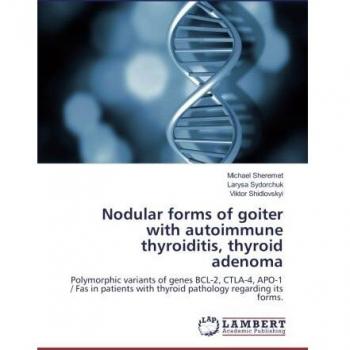 Nodular forms of goiter with autoimmune thyroiditis thyroid adenoma