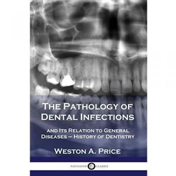 The Pathology of Dental Infections: and Its Relation to General Diseases
