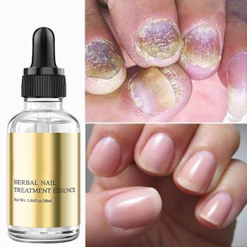 Sérum réparateur d'ongles aux plantes