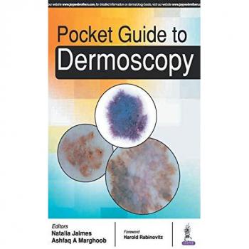 Pocket Guide to Dermoscopy