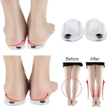 Heightening Insoles for O-Shaped and X-Shaped Legs