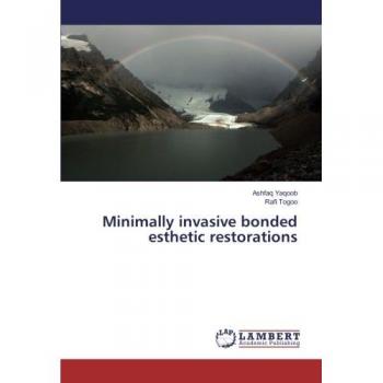 Minimally invasive bonded esthetic restorations