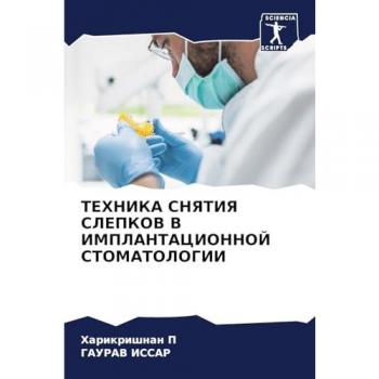 P, Harikrishnan: TEHNIKA SNYaTIYa SLEPKOV V IMPLANTACIONNOJ STOMATOLOGII