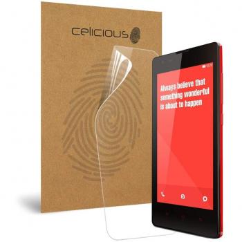 Redmi Resilience – Impact‑Resistant Screen Film