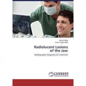 Radiolucent Lesions of the Jaw: Radiographic Diagnosis & Treatment