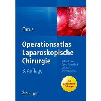 Operationsatlas Laparoskopische Chirurgie: Indikationen