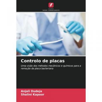 Controlo de placas: Uma visão dos métodos mecânicos e químicos para a remoção da placa bacteriana