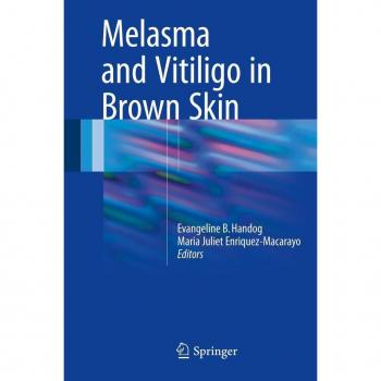 Vitalsource Technologies, Inc. Melasma And Vitiligo In Brown Skin