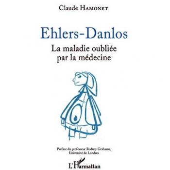 Ehlers-Danlos