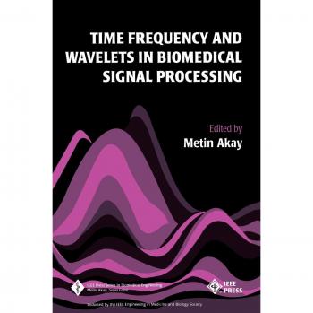 Time Frequency and Wavelets in Biomedical Signal Processing
