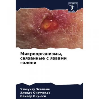 Микроорганизмы, связанные с язвами голени: DE